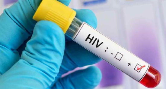 මෙරටින් වාර්තා වන HIV අසාදිතයින් සංඛ්‍යාව ඉහළට